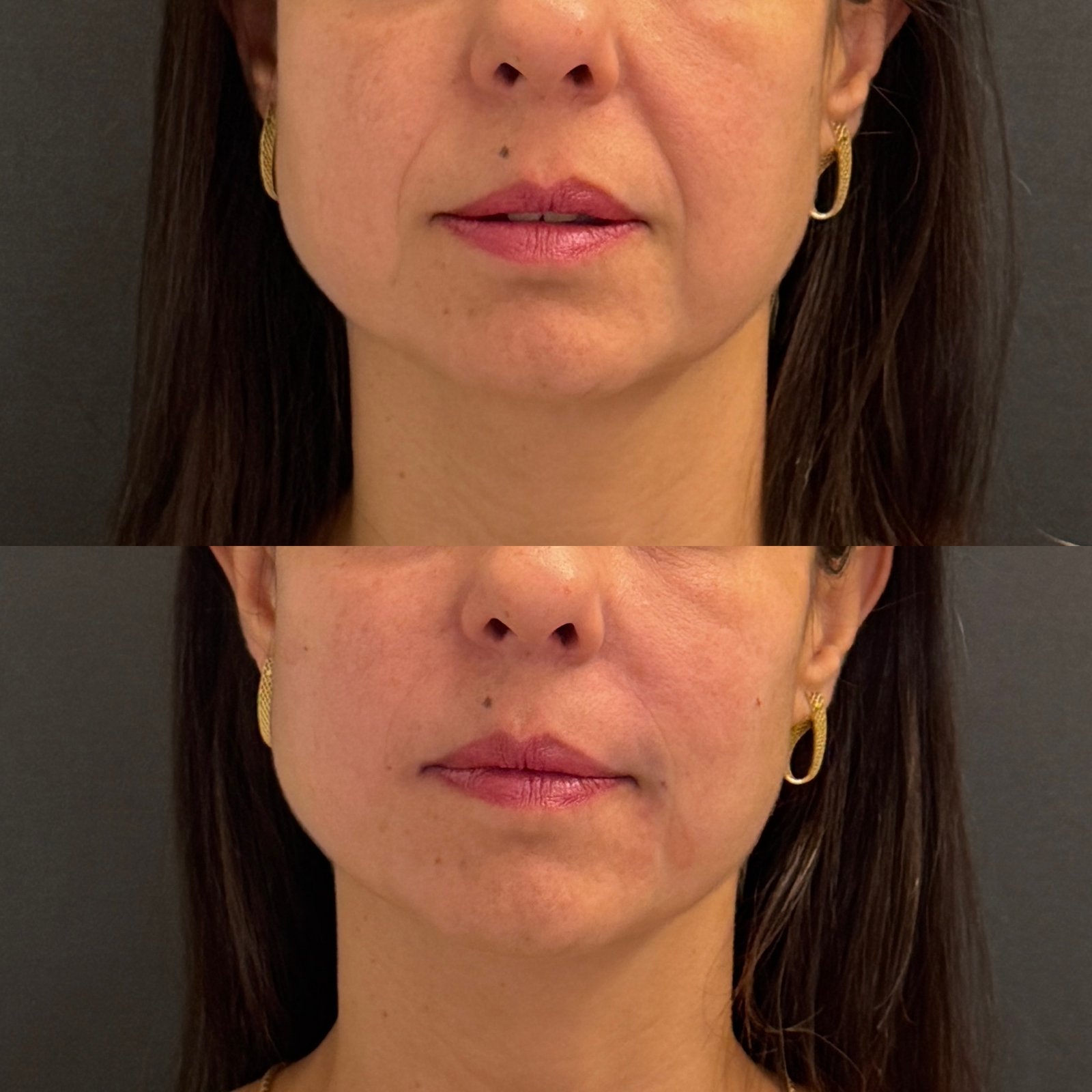 C706A296-CADE-4D1E-8551-B7270EBCE3D6