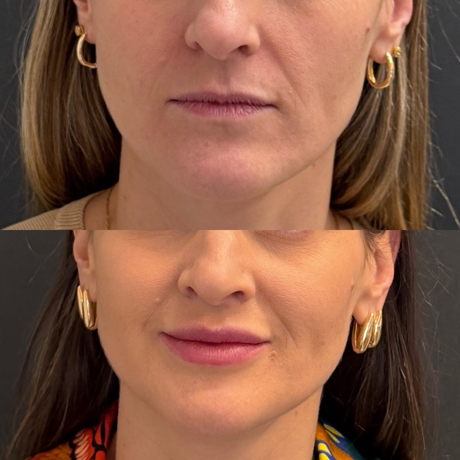 DAC3982E-0157-4015-B1CB-375C1E33C189